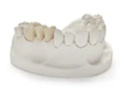 Titanium Coping Layered with Ceramic dental laboratory solution