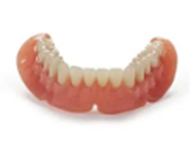 Removable partial denture and cast framework solution
